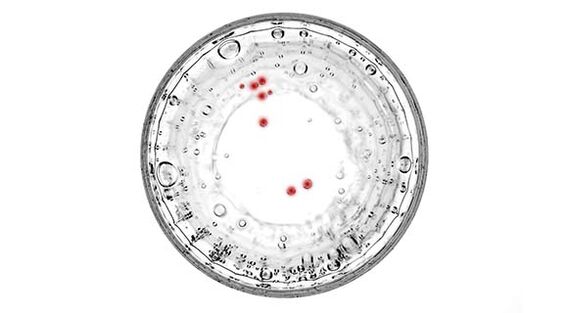 Dacă aveți simptome de prostatita, ar trebui să fiți testat pentru infecții ascunse.